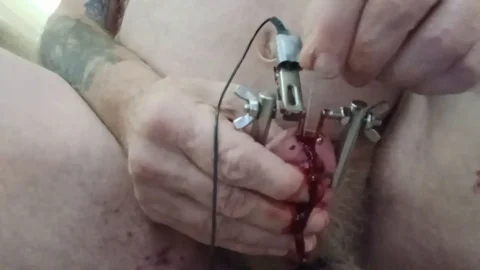 Ruined Cock Forever – Permanent Damage Self Torture