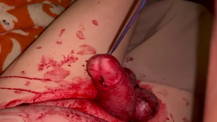 Banded with Elastrator and Being Cut