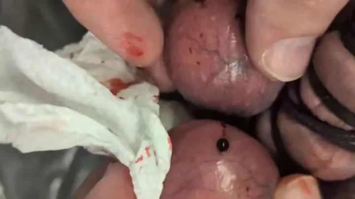 Some CBT with needles