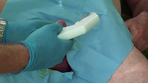 Penis Stapling for slave Renne (Part 2) | PenisCrush.com