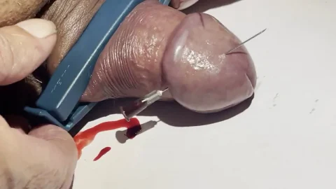 Two Needles in hes Cockhead