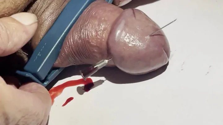 Two Needles in hes Cockhead