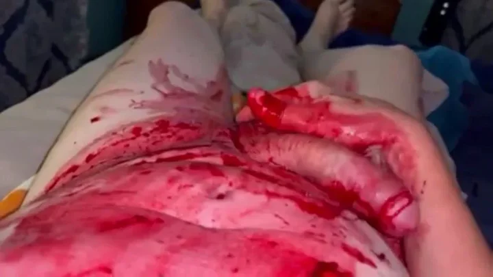 Attempting to cum from my damaged cock