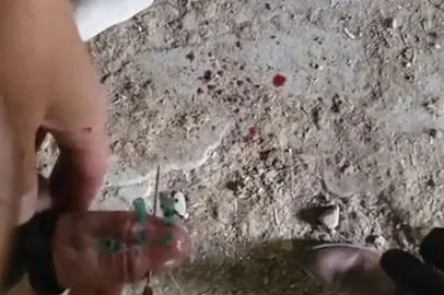 Cock Head Filled with Needles Brutal Pain