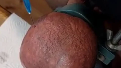 60 Minutes of CBT – Needles and Insertions Compi | PenisCrush.com