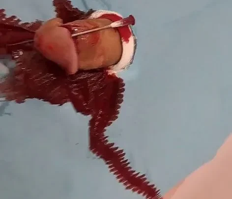 A needle in my cockhead makes me cum 16G