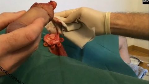 Castration And Cutting Penis – Compilation Of Operations