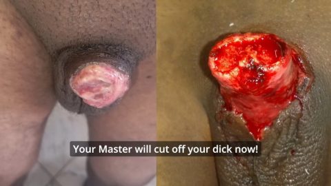 PENECTOMY – Guide to getting your dick cut off | PenisCrush.com