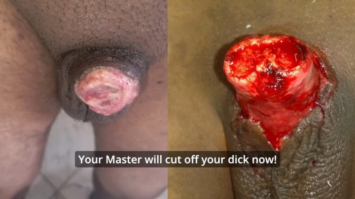 PENECTOMY – Guide to getting your dick cut off | PenisCrush.com