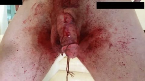 Scalpel and spiked Shoes – Heavy Bleeding Genital Destruction | PenisCrush.com