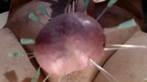 16 Needles In Balls