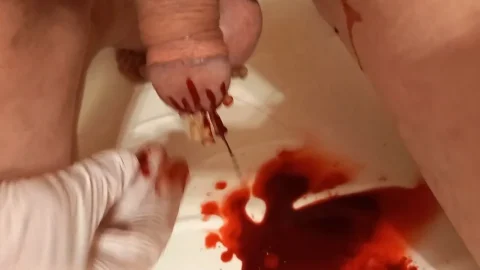 Needles Causing Massive Genital Bleeding | PenisCrush.com