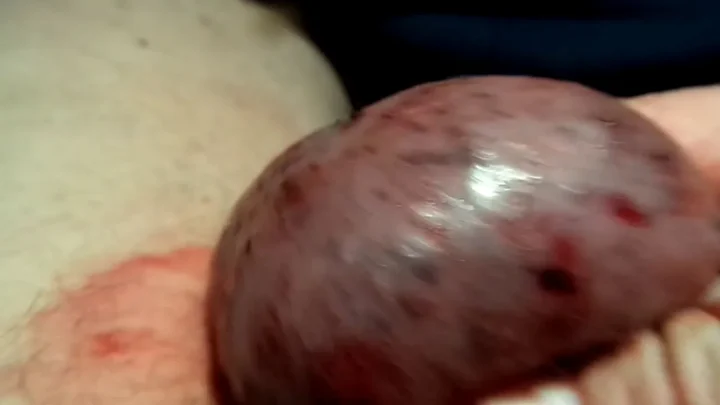 Easy to store a pin stuck in my testicle | PenisCrush.com