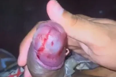 Burning penis over gas cooker | PenisCrush.com