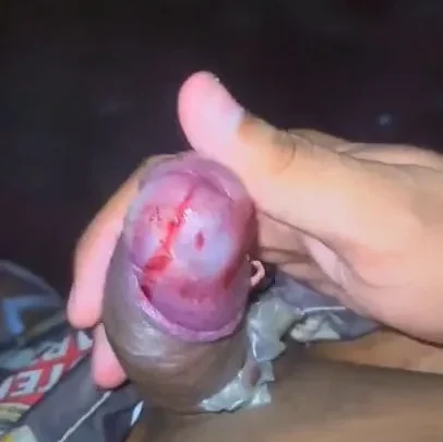 Burning penis over gas cooker | PenisCrush.com