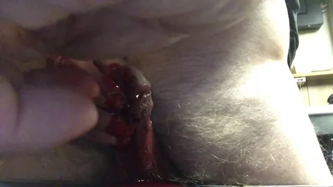 Long Screw insert – massive blood loss | PenisCrush.com