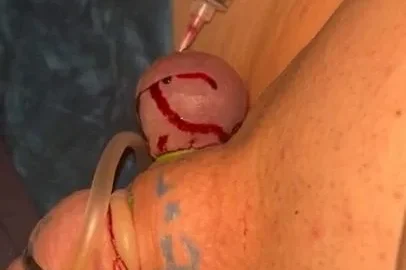Destroying Bloody cock and balls | PenisCrush.com