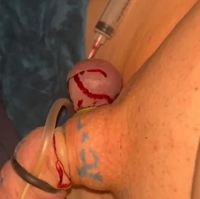 Destroying Bloody cock and balls | PenisCrush.com