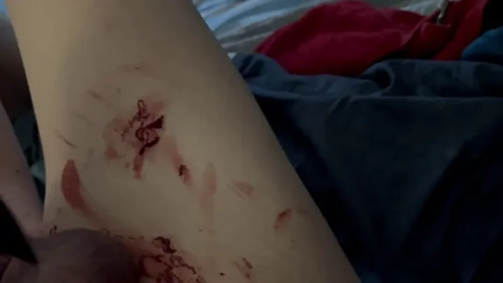 Extreme Self Bloodletting CBT | PenisCrush.com